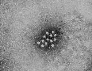 Hepatitis A: Symptoms in children