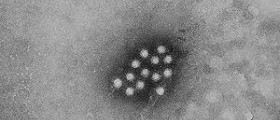 Hepatitis A: Symptoms in children