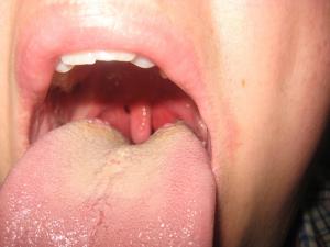 Herbs for tonsils