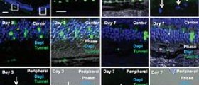 Hereditary eye disease