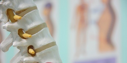 Corrective Exercises For Herniated Disc