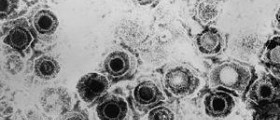 Herpes in pregnancy review