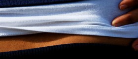 Hip Dysplasia - An Overview