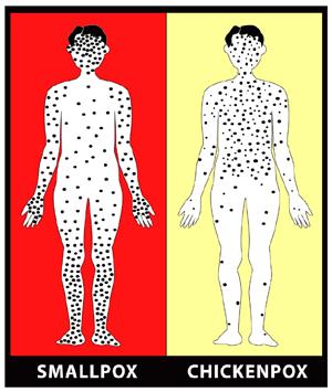 History and origin of smallpox