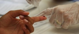 Early Start Of HIV Treatment Benefits Patients' Long-Term Health