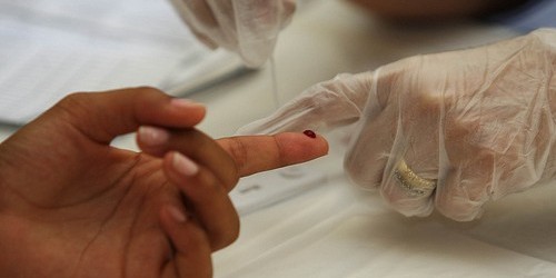 Early Start Of HIV Treatment Benefits Patients' Long-Term Health