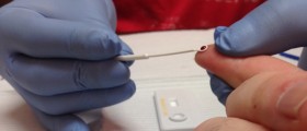 New HIV Testing Methods Offer Faster Treatment