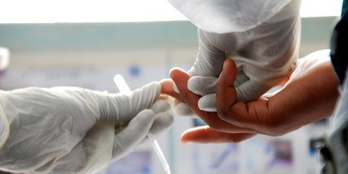 Sixty-Second HIV Testing Now Available In The USA