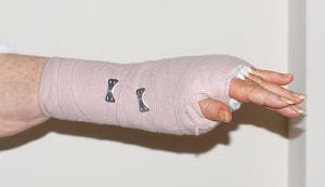 Home treatment for carpal tunnel