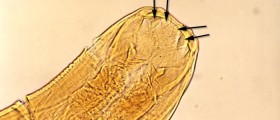 Would You Recognize These Dangerous Parasitic Infestations?