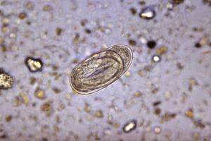 Hookworms in humans