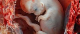 How long does a miscarriage last