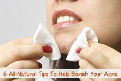 How to get rid of pimples fast