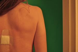 How to prevent skin cancer
