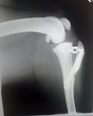 How to treat a ligament injury