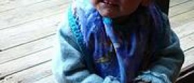 How to treat fever blisters in toddlers