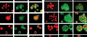 Cells Act Like Tape Recorders To Monitor Health