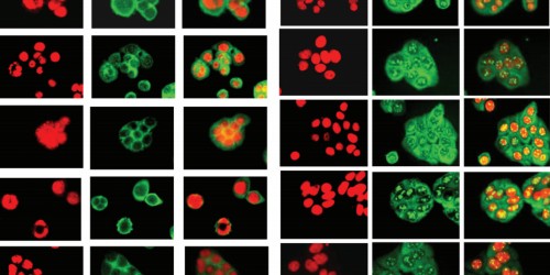 Cells Act Like Tape Recorders To Monitor Health