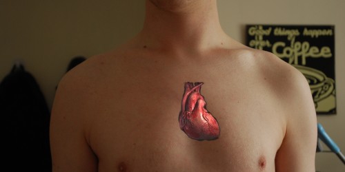 Statin: Drug for Heart Disease