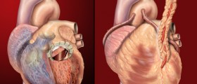 Heart palpitations: Causes, Risks & Treatment