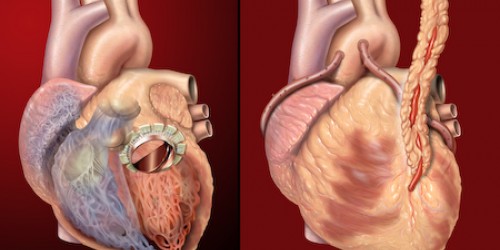 Heart palpitations: Causes, Risks & Treatment