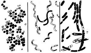 If you're a regular user of tampons you should be aware of toxic shock syndrome!