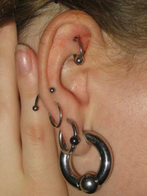 Infected ear piercing causes and symptoms