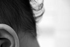 Infected hair follicle treatment