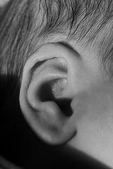 Information about Otitis Media in children