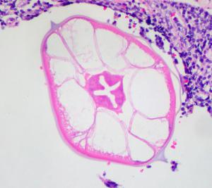 Information about pinworms in humans