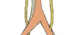 Information on urinary tract obstructions