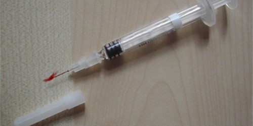 Managing Hepatitis C with Interferon Therapy