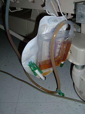 Intermittent catheterization for urine control