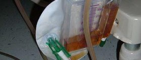 Intermittent catheterization for urine control