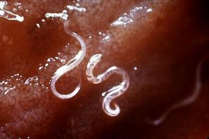 Intestinal parasites symptoms