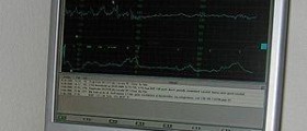 Intrapartum fetal monitoring