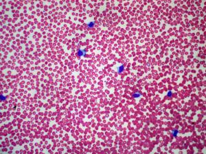 Is a bacterial infection contagious