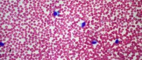 Is a bacterial infection contagious
