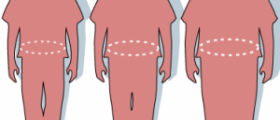 Is bariatric surgery the answer to obesity?