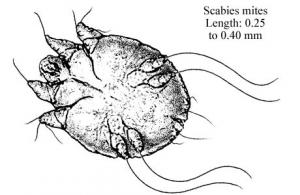 Is scabies contagious