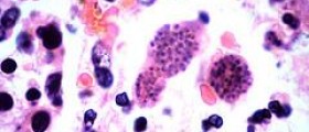 Is there a higher risk to your pregnancy because of toxoplasmosis?