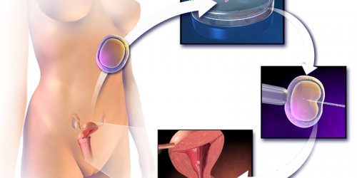 Genetic Screening Of Eggs Could Increase IVF Success