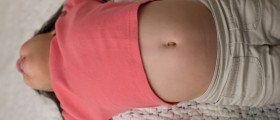 Everything You Need To Know About Umbilical Hernias In Children
