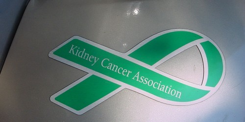 Kidney Cancer, Once Inevitably Fatal, Now May Be Curable with IL-2