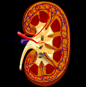 Kidney stone cure - more ways than water to flush kidney stones painlessly