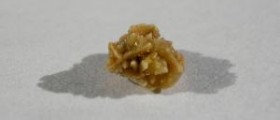 Kidney stone flush - what to do when water won’t flush your kidney stones?