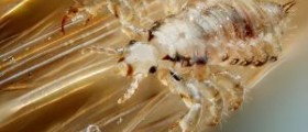 Kill the lice and stop the itch !