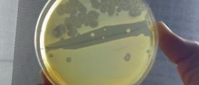 Klebsiella pneumoniae review
