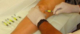 Hyaluronic Acid And Prophylaxis Of Arthritis Complications