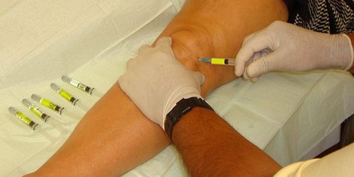 Hyaluronic Acid And Prophylaxis Of Arthritis Complications